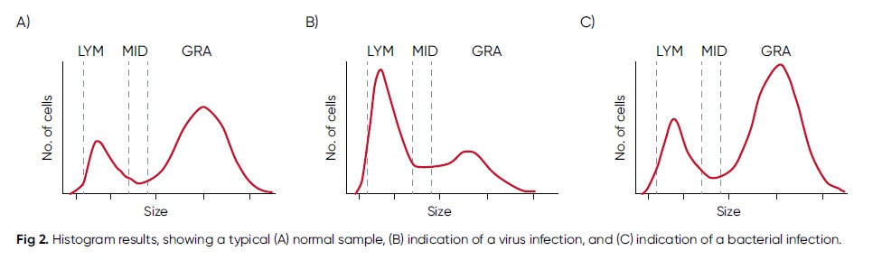 CBC in infectious diseases - Boule