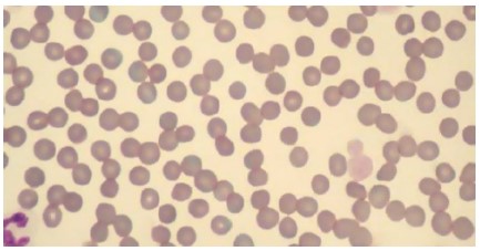 Picture of blood cells 