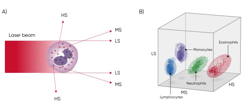 (A) Three-angle laser-scatter method, where the low angle signal (about 1° to 5°) represents the cell volume information, the middle angle signal (about 7° to 20°) represents the cell nucleus information, and the high angle signal (about 90°) represents the cell nucleus and cytoplasm information. (B) In laser-based WBC differentiation, cell distribution is displayed in a 3D diagram, with the low, mid, and high angle light scatter signals on the axes (scattergram).