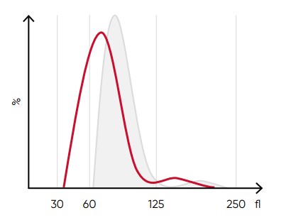 A shift of the RBC histogram to the left gives an indication of microcytic RBCs (smaller than normal).