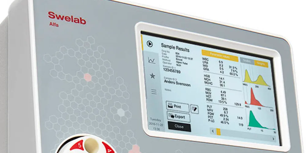 Sample result on Swelab Alfa Plus hematology analyzer